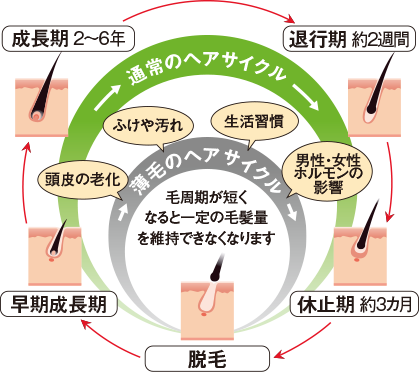 抜け毛 薄毛について 薬用育毛剤 柑気楼 公式サイト 抜け毛 薄毛について 薬用育毛剤 柑気楼 公式サイト